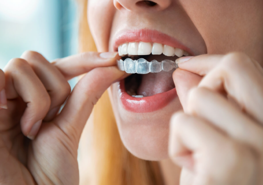 How to Choose a Teeth-Straightening Option That Fits Your Life in Delaware, Ohio