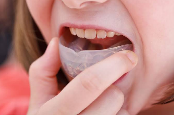 Top 10 Things to Know About Occlusal Splint Therapy